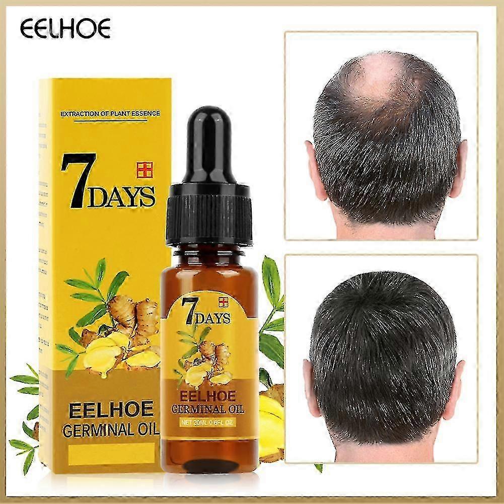 1pc ג'ינג'ר צמיחת שיער מהירה 7 יום ג'ינג'ר Germinal סרום תמצית טבעית נשירת שמן טיפול צמיחת שיער שיער