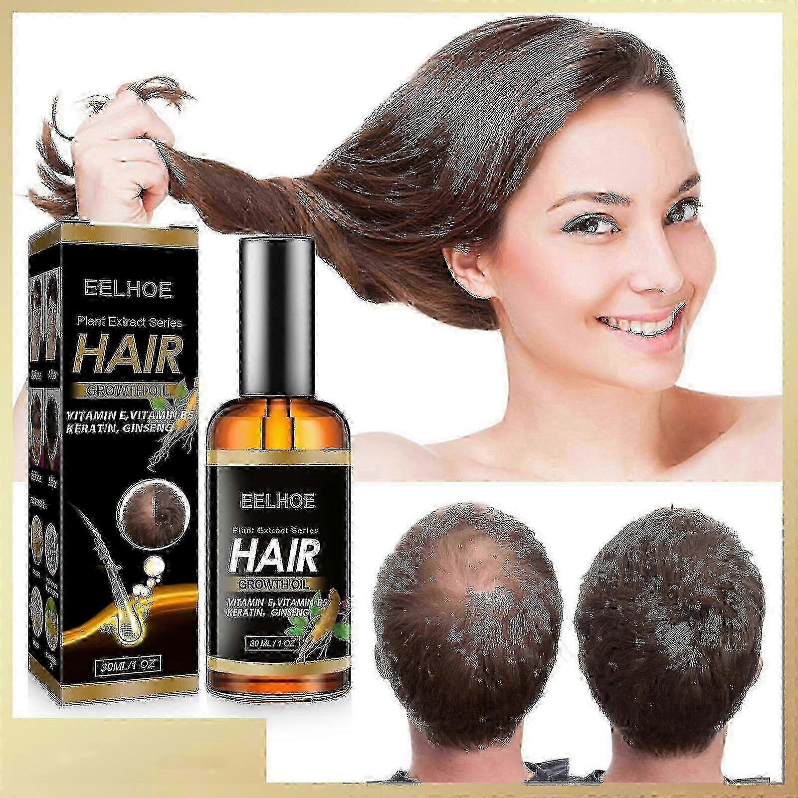 Ingwer Haarwuchsöl 30ml -