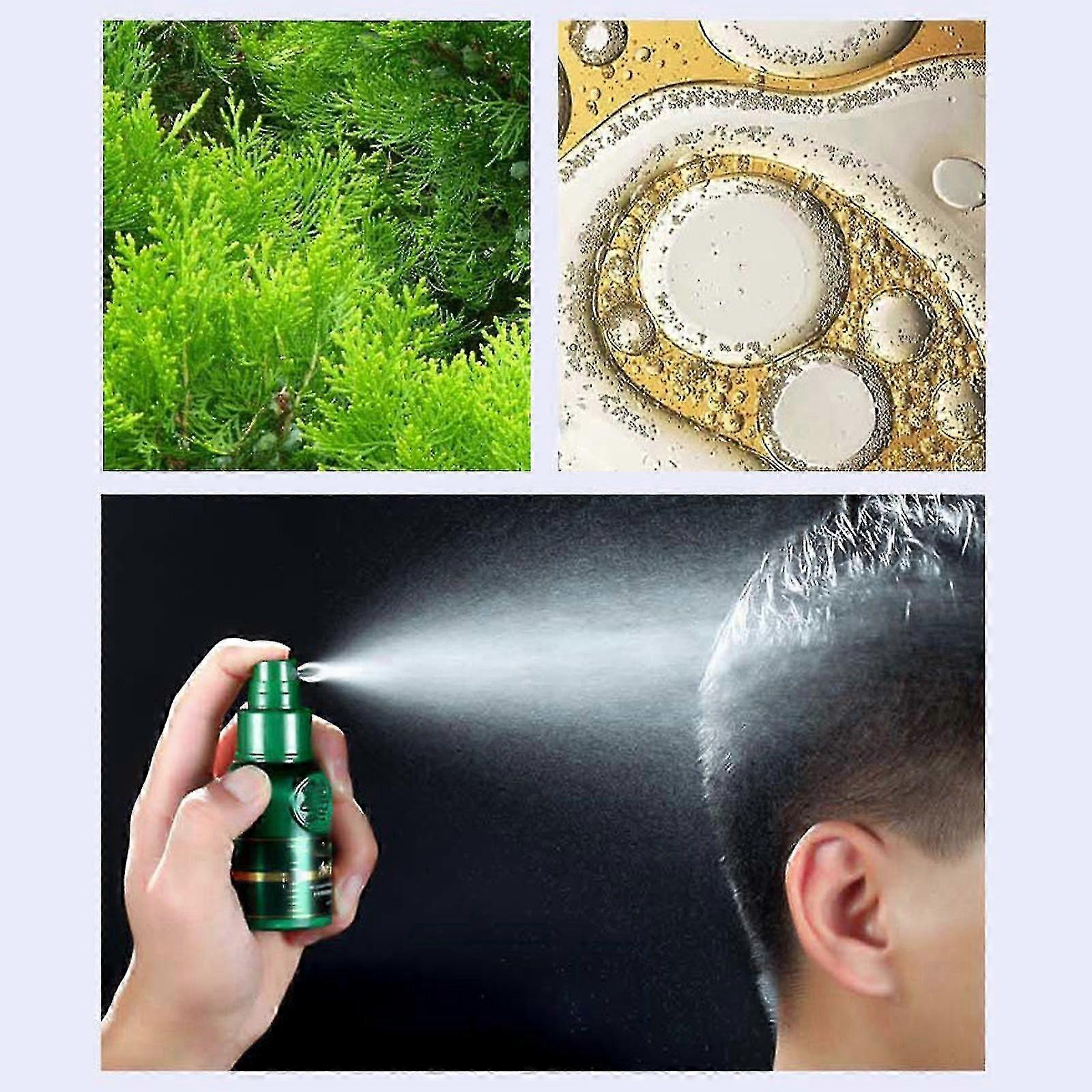 50ml ספריי לצמיחת שיער ספריי נגד הסרה ג'ינג'ר קינג שיער טיפולי נוזלי להרמת שיער