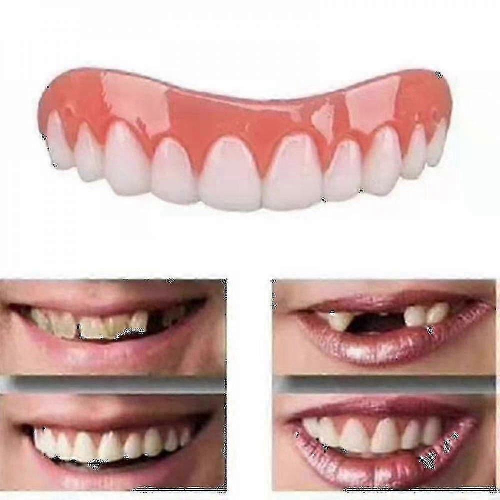 Natural-Looking Adjustable Dentures Set