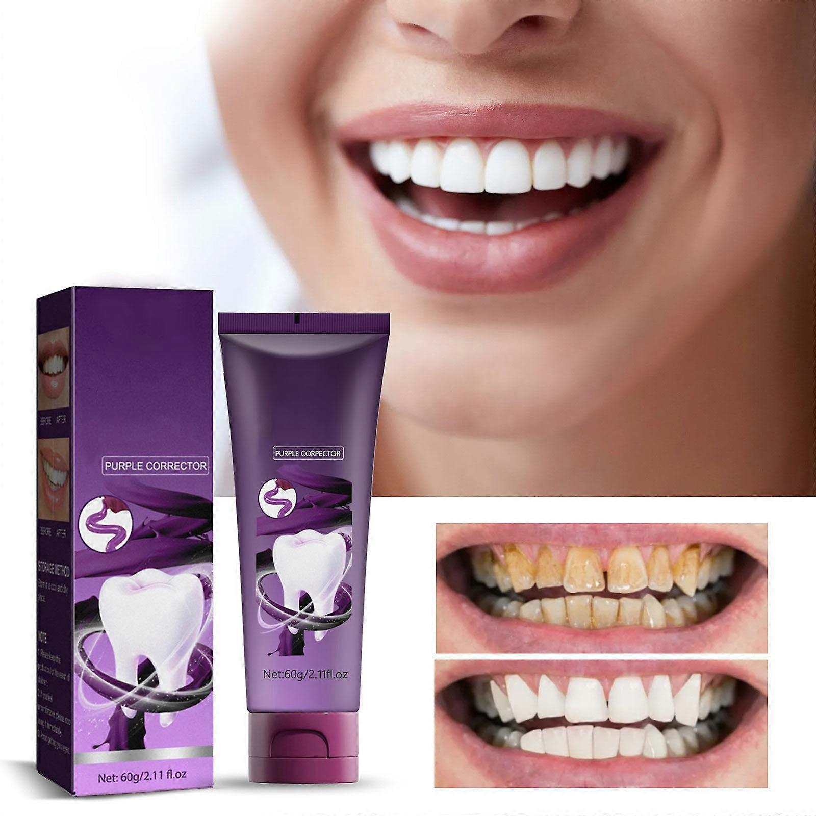Whitening Teeth Cleaning Oral Cavity Refreshing And Removing Calculus Toothpaste 60g