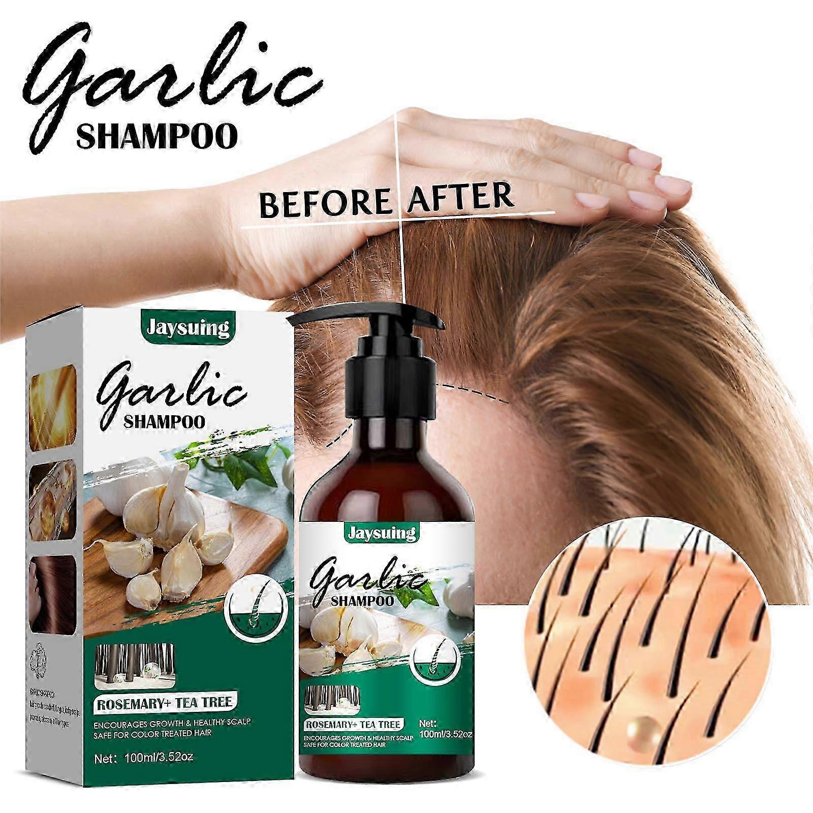2025 Shampooing à l’ail non parfumé pour cheveux normaux à secs Les cheveux ultimes avec de l’extrait d’huile d’ail non parfumé 100ml