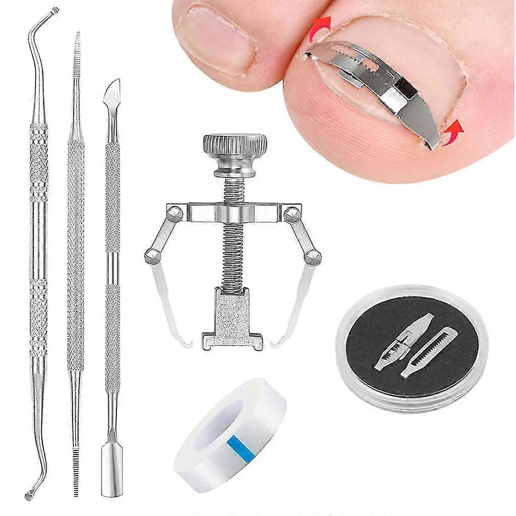 Ingrown Toenail Corrector Buckle Kit Corrector Ingrown Toenail Tool Kit