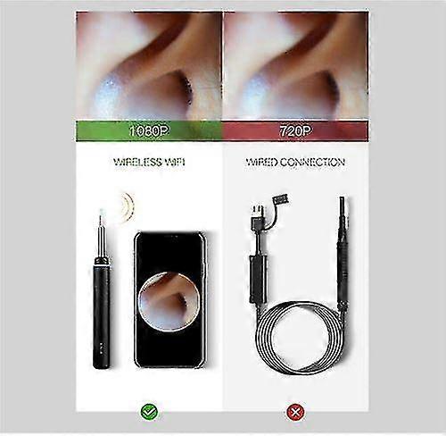 Bebird M9 Pro Otoscope スマートビジュアル耳クリーニングスティック 1080p HDデジタル内視鏡(ブラック)