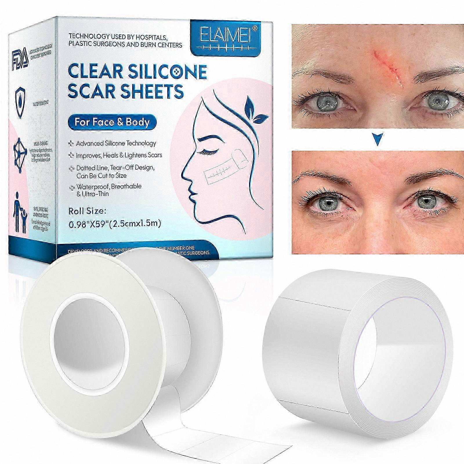 Reusable Silicone Scar Strips for C-Section, Keloid, 1.5M x 2.5CM Roll