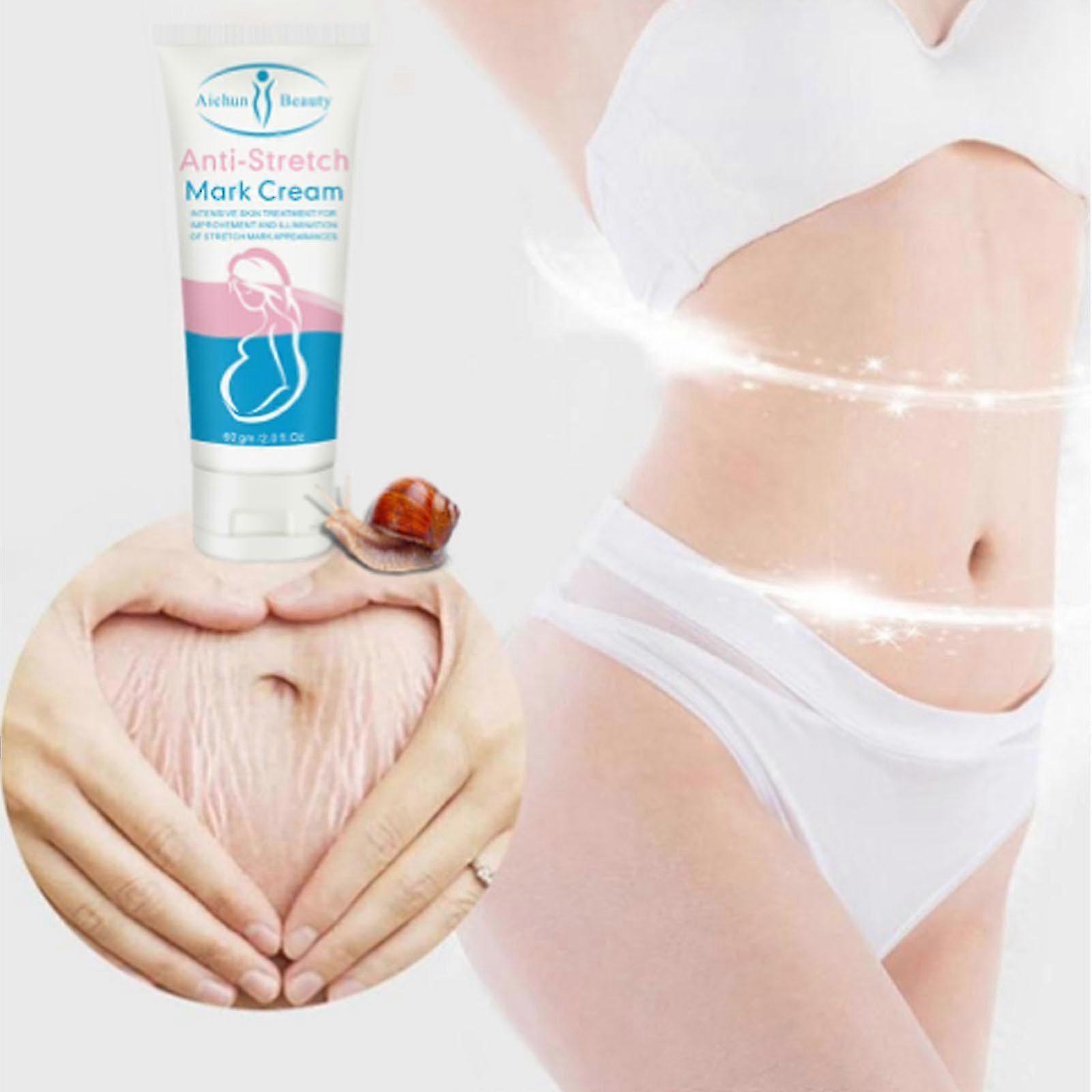 マタニティのためのアンチストレッチマークリムーバーローションクリームスキンリペア
