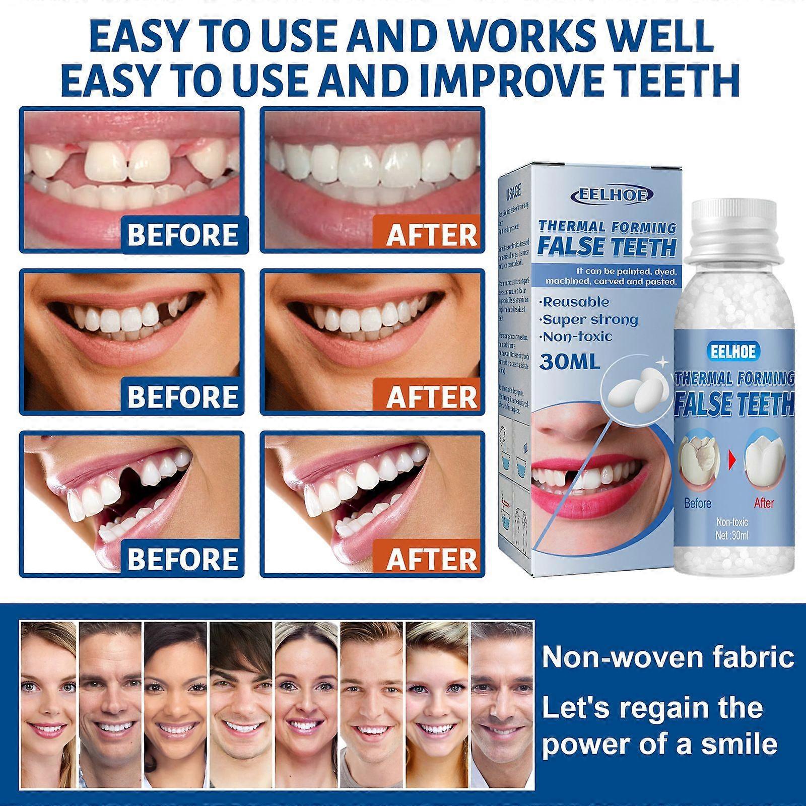 EELHOE Thermal Forming False Teeth Tooth Repair Kit Tooth Repair Granules for Missing and Broken Tooth Temporary Teeth Filling Repair Kit