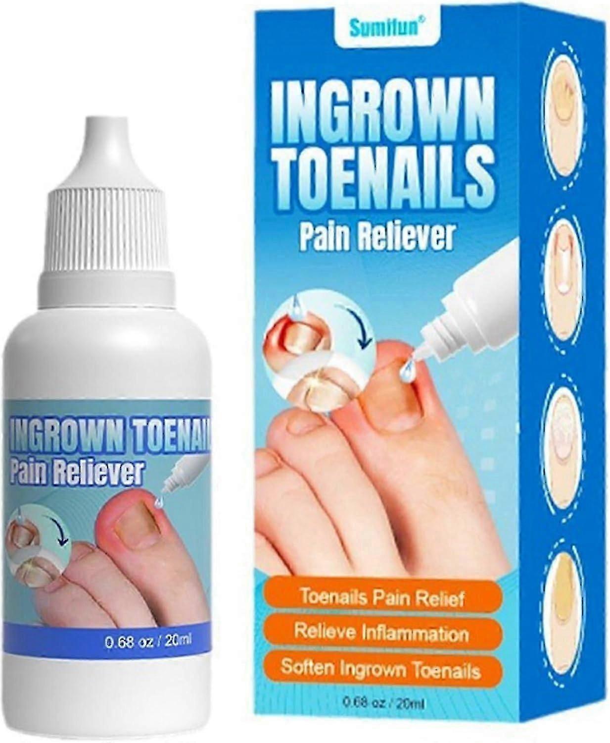 Inngrodd tånegl sterk, 20 ml inngrodd tånegldråpe, neglebåndspleieolje for inngrodde tånegler