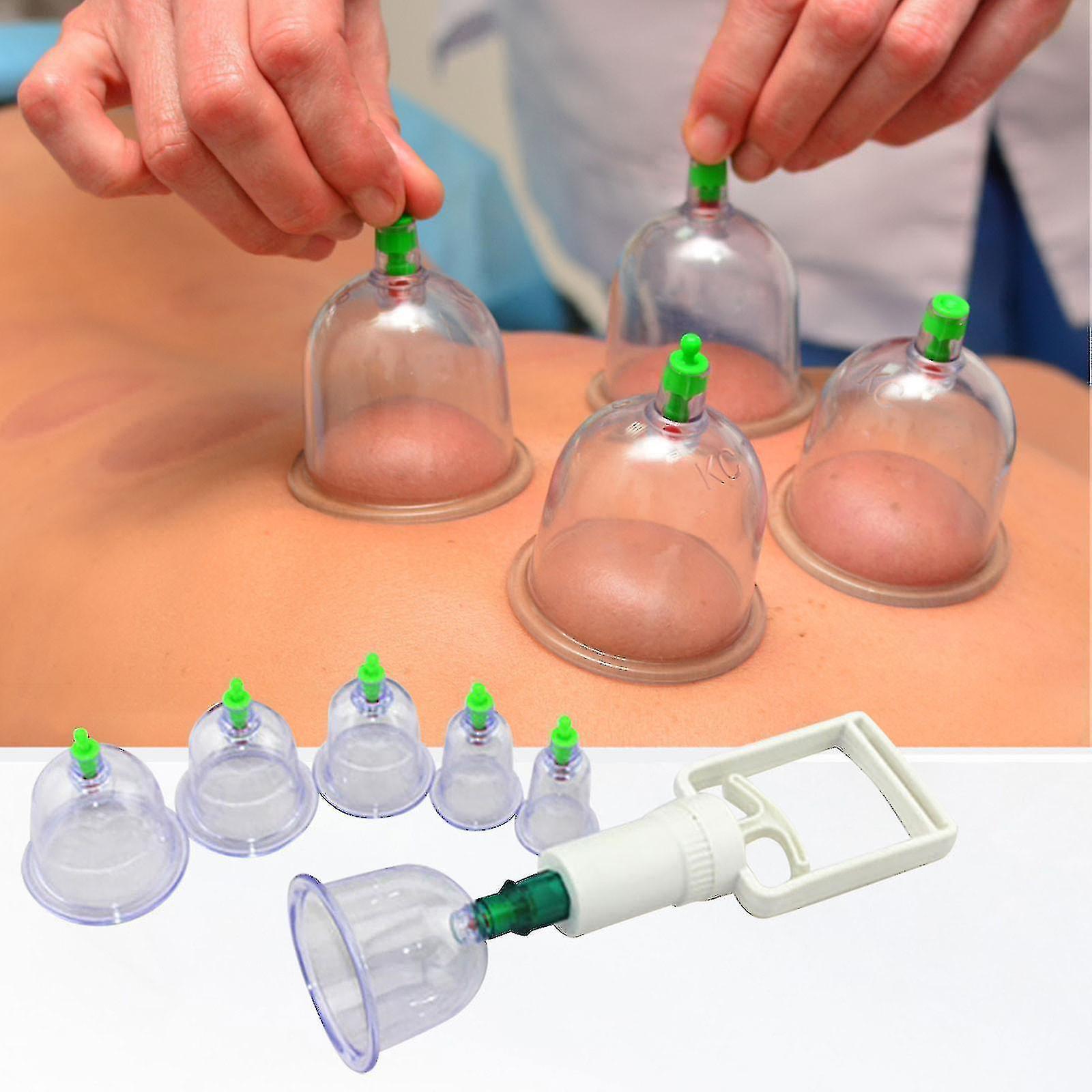 1 Set 6 tazze Hijama Cupping Set con pompa Ventose a vuoto per corpo Cellulite Coppettazione Massaggio mal di schiena Sollievo dal mal di schiena