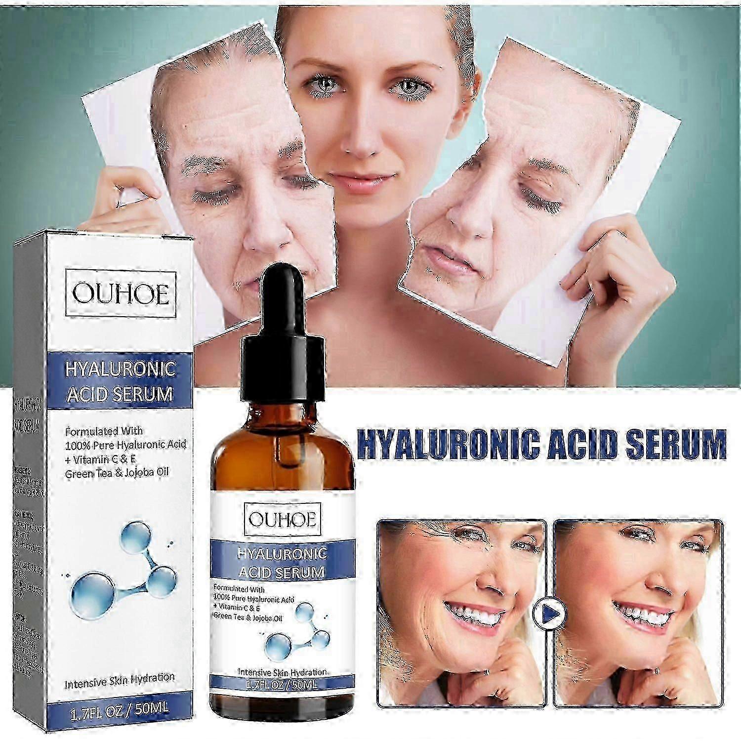 OUHOE Anti-Aging Essence, Lighten Lines Shrink Pores Tighten Moisturize Essence