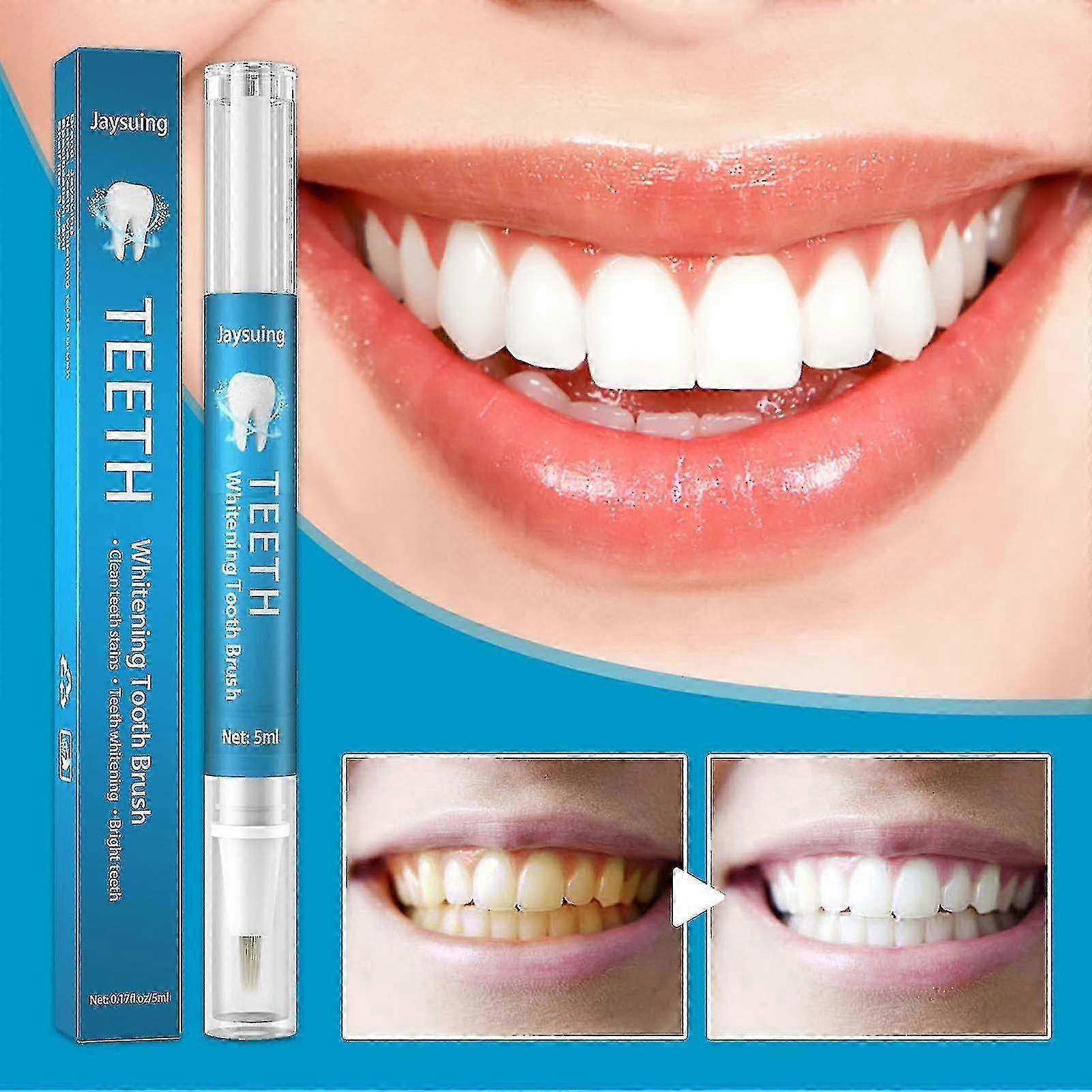 Jaysuing Teeth Whitening Pen