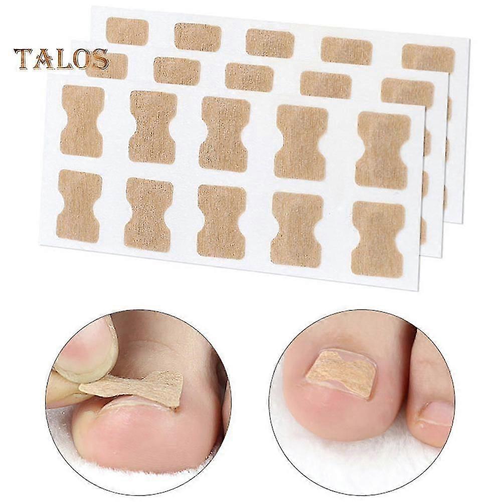 50Pcs Ingrown Toe Nail Correction Sticker Corrector