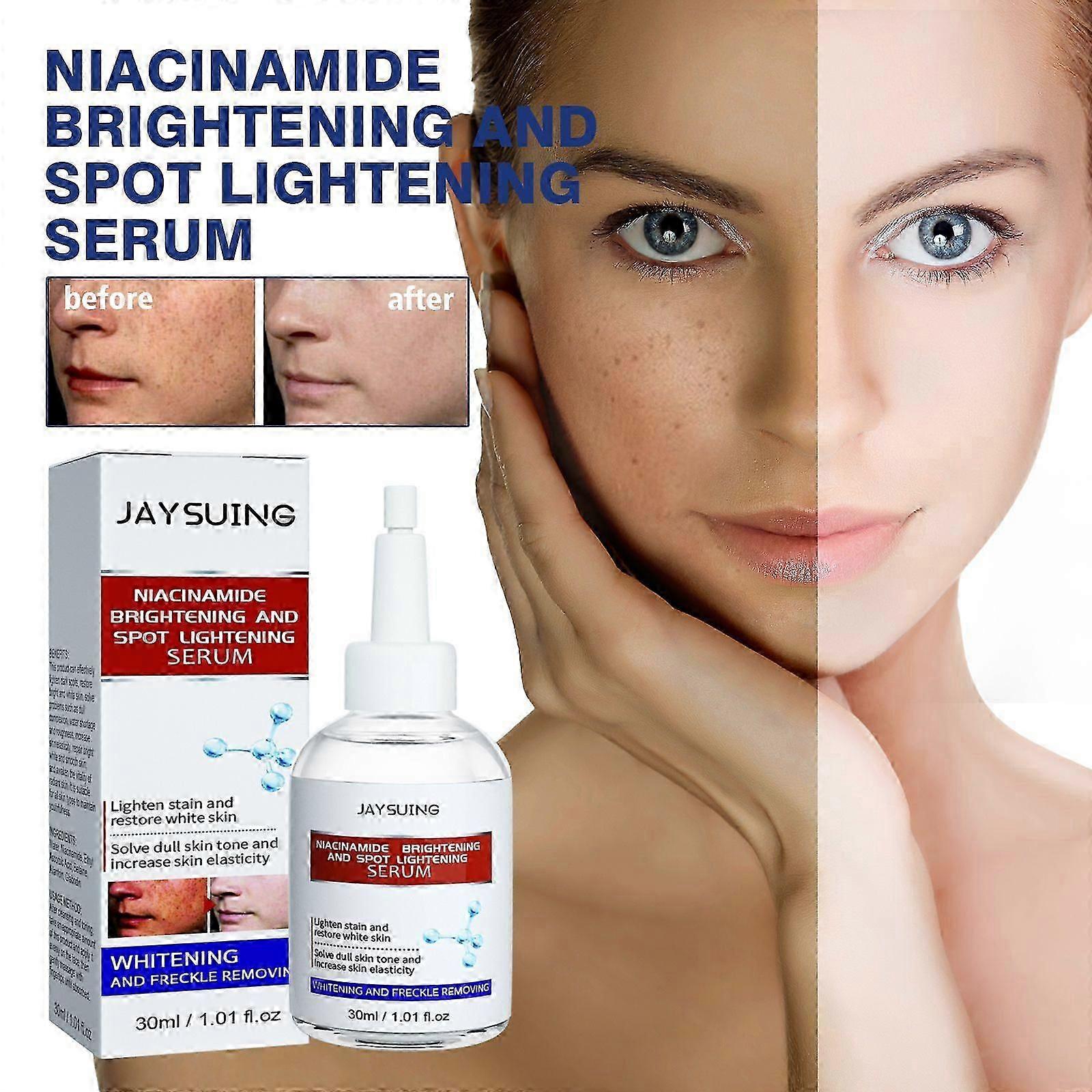 Nicotinamide Brightening Serum for Dark Spot Removal