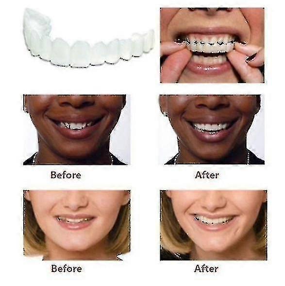 A Pair Upper  Lower High Quality Denture Instant Smile Comfort
