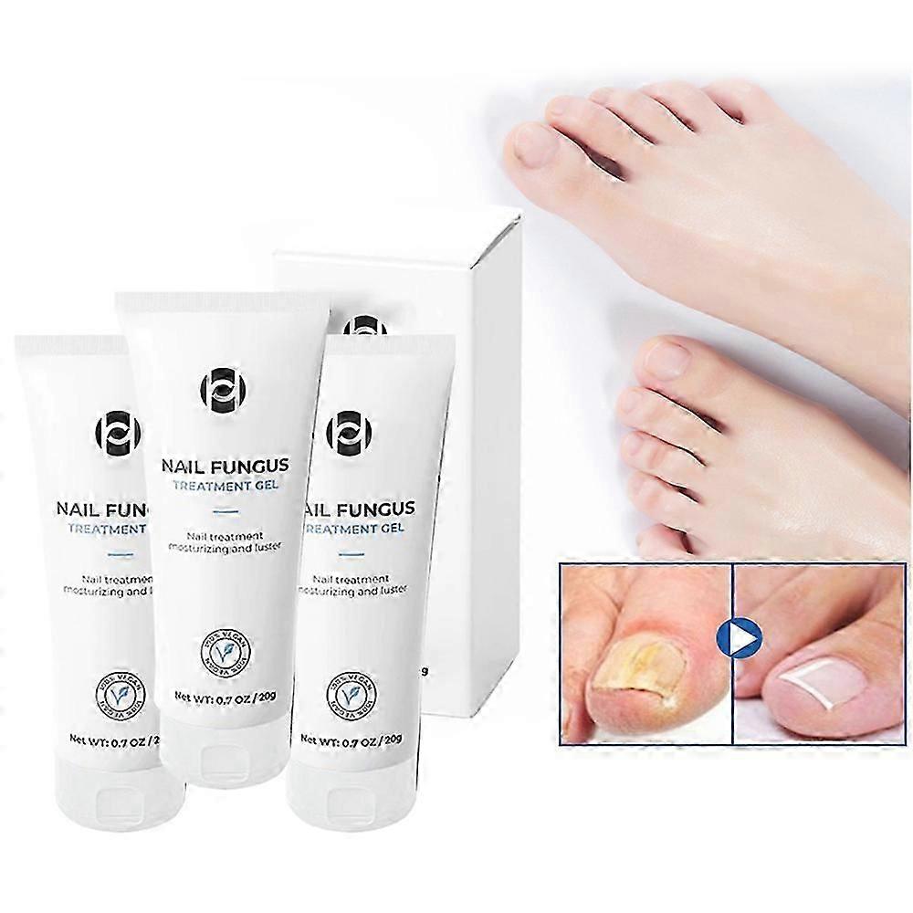 3pcs ヘリオ ネイル トリートメント ジェル ネイルケア ジェル ネイル シックニング ネイル ブライトニング ネイル