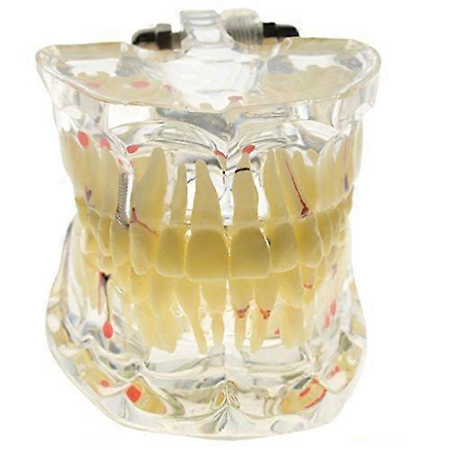 1piece Adult Pathologies Demonstration Model Dental Study Model