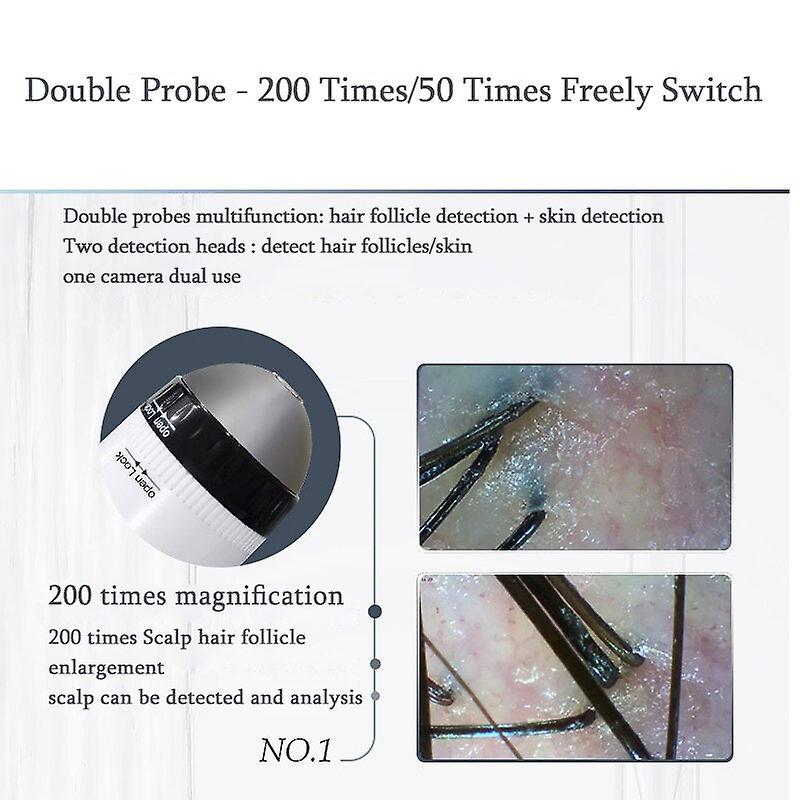 Professionnel sans fil hd intelligent cuir chevelu / peau / dermique