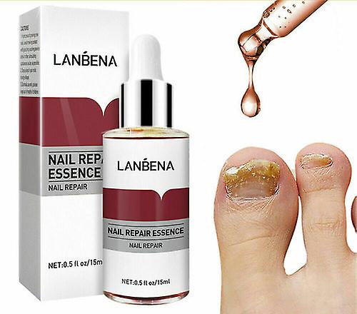 Nail Repair Essence Remove Onychomycosis Serum Μυκητιασική θεραπεία νυχιών