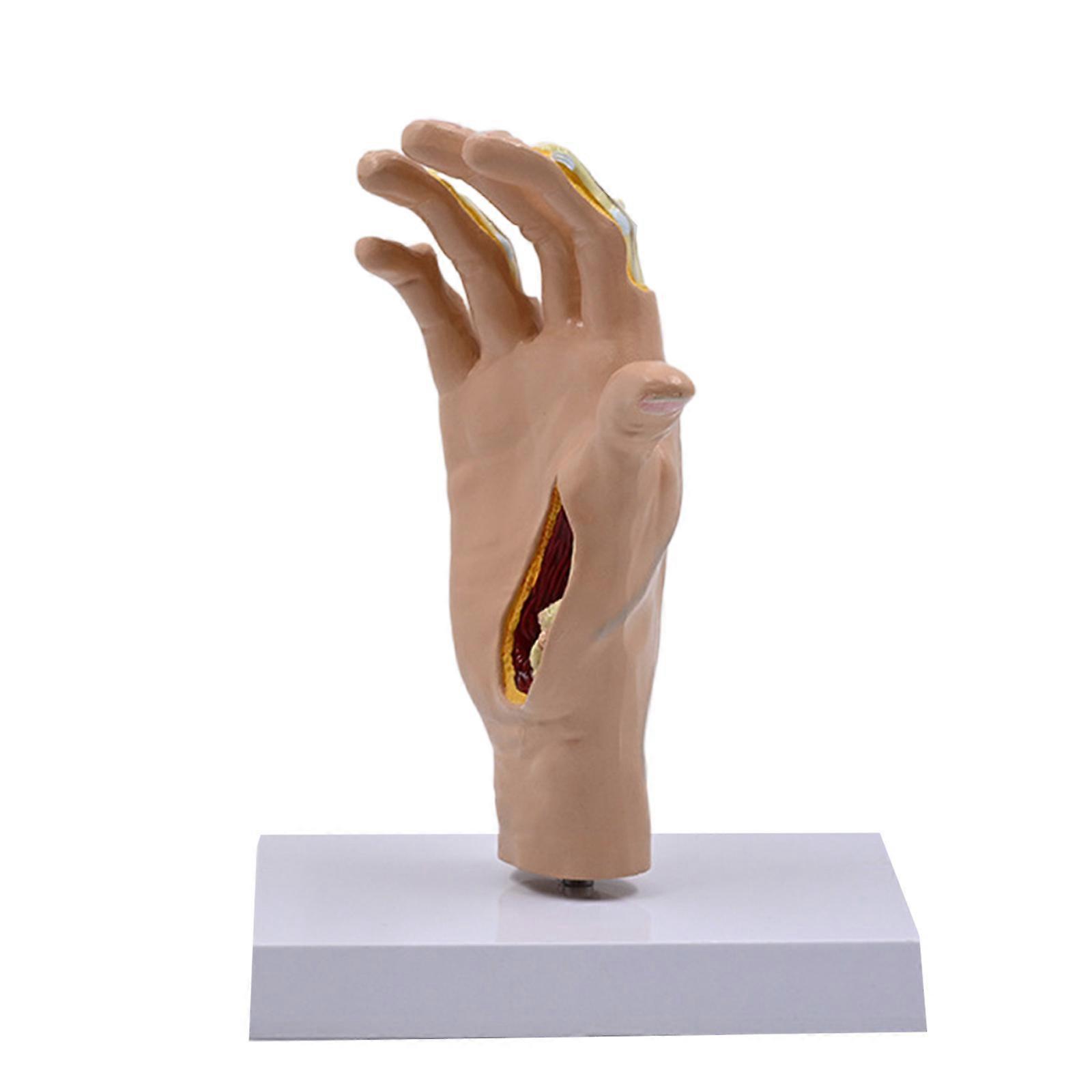 Hand Skeleton Model with Ligaments Muscles 1:1 Hand Joint Model Medicals Model for Patient Education Multicolor