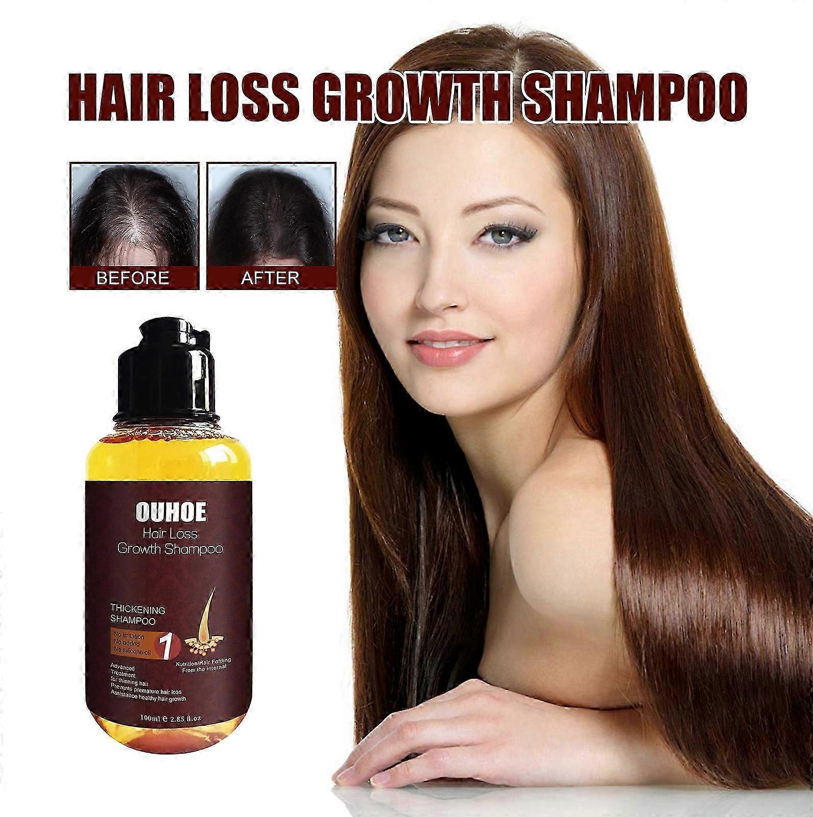 OUHOE shampoo gently cleanses scalp, moisturizes and brightens hair, cares for soft and smooth hair, and solidifies hair