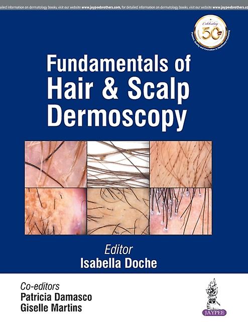 Fundamentals Of Hair And Scalp Dermoscopy by Giselle Martins Paperback Book
