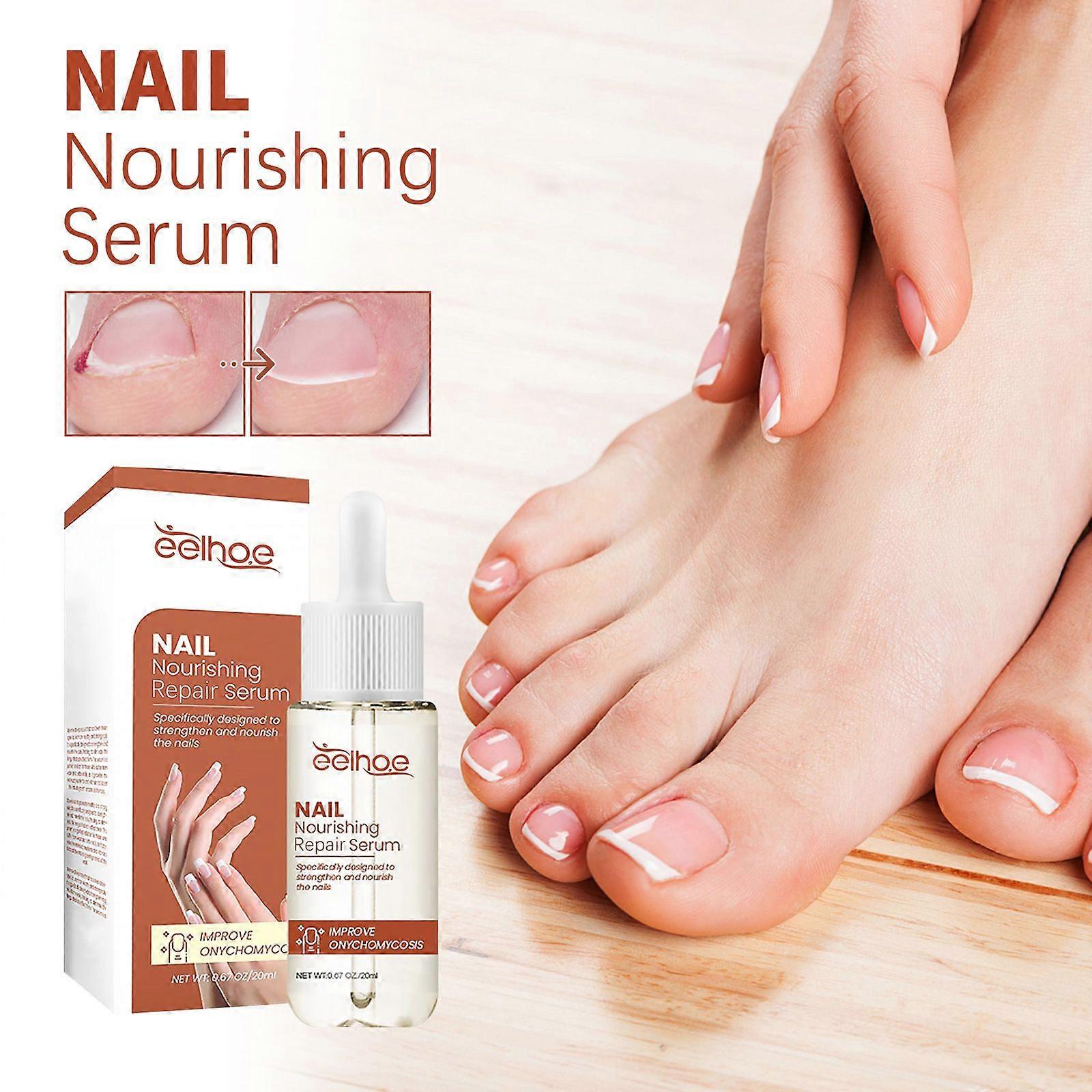 Strengthening Nail Polish, 20 ml Nail Polish Strengthening Treatment for Weak and Flaky Nails, Enamels Hardener Strengthening Nails, Treatment for Bri