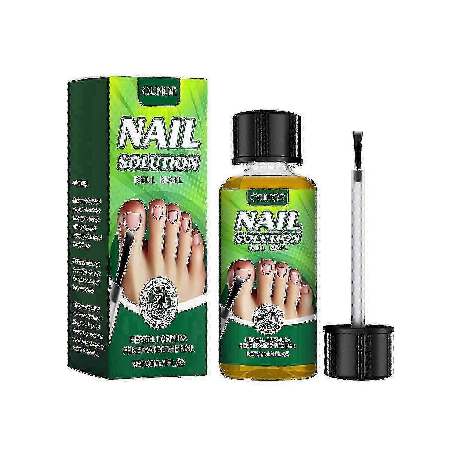 Solution pour les ongles, Solution réparatrice pour les ongles, Soins des ongles contre l’onychomycose Solution de soin douce pour la réparation des ongles, renforce et hydrate les ongles fins