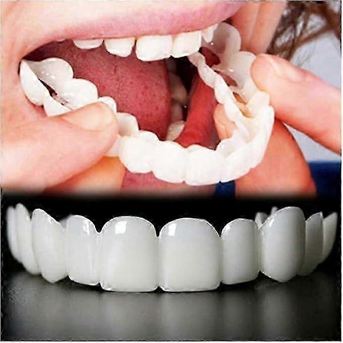 Temporarily Adjustable Smile Aligners