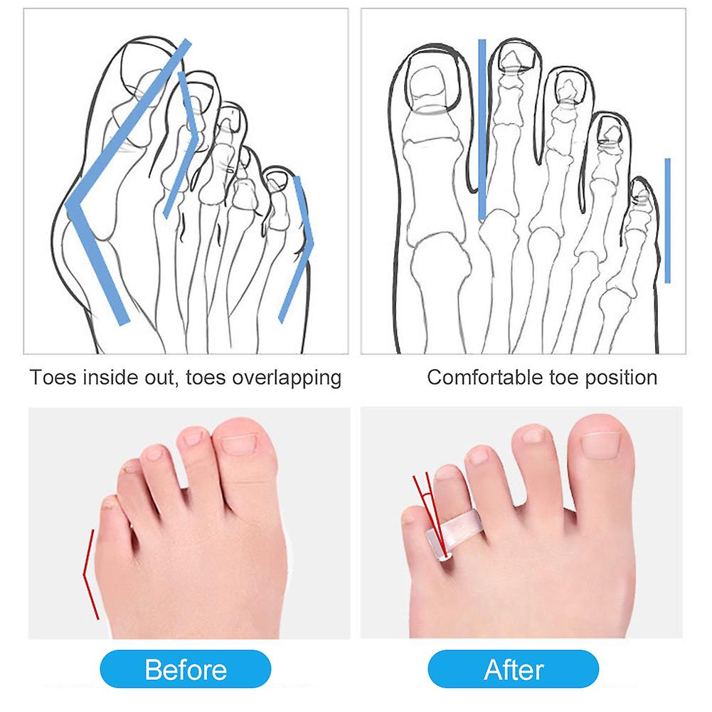 Toe Splitter Toe Spreader Bunion Corrector Anti-abrasion Silicone Protector