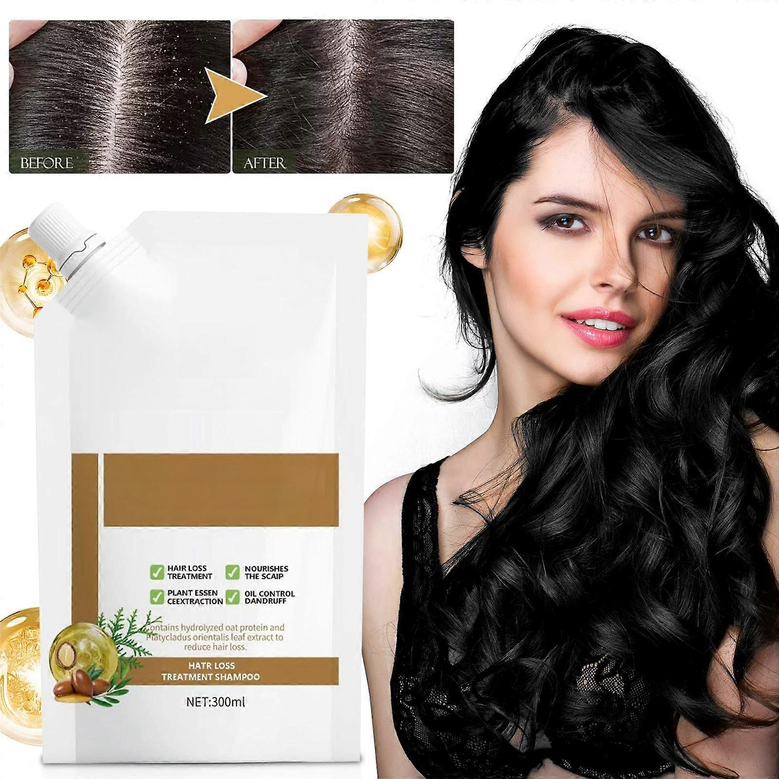 Cheveux Chute Cheveux Shampooing Contrôle Huile Pellicules Perte de cheveux Rambut Rontok Perawatan 300ml Style G