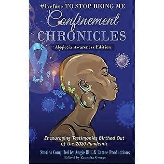 #Irefuse smettere di essere me stesso: Confinement Chronicles Alopecia Awareness Edition