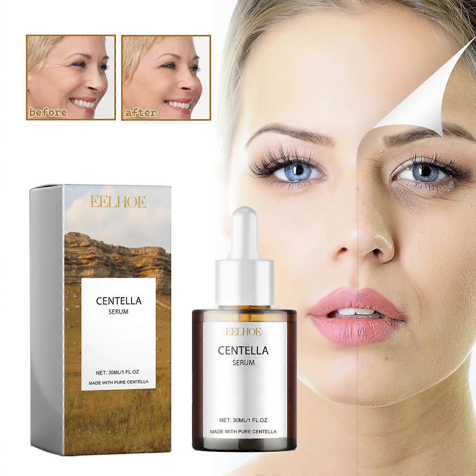 Centella Asiatica Ampoule Facial Serum Soothes Acne Prone and Sensitive Skin