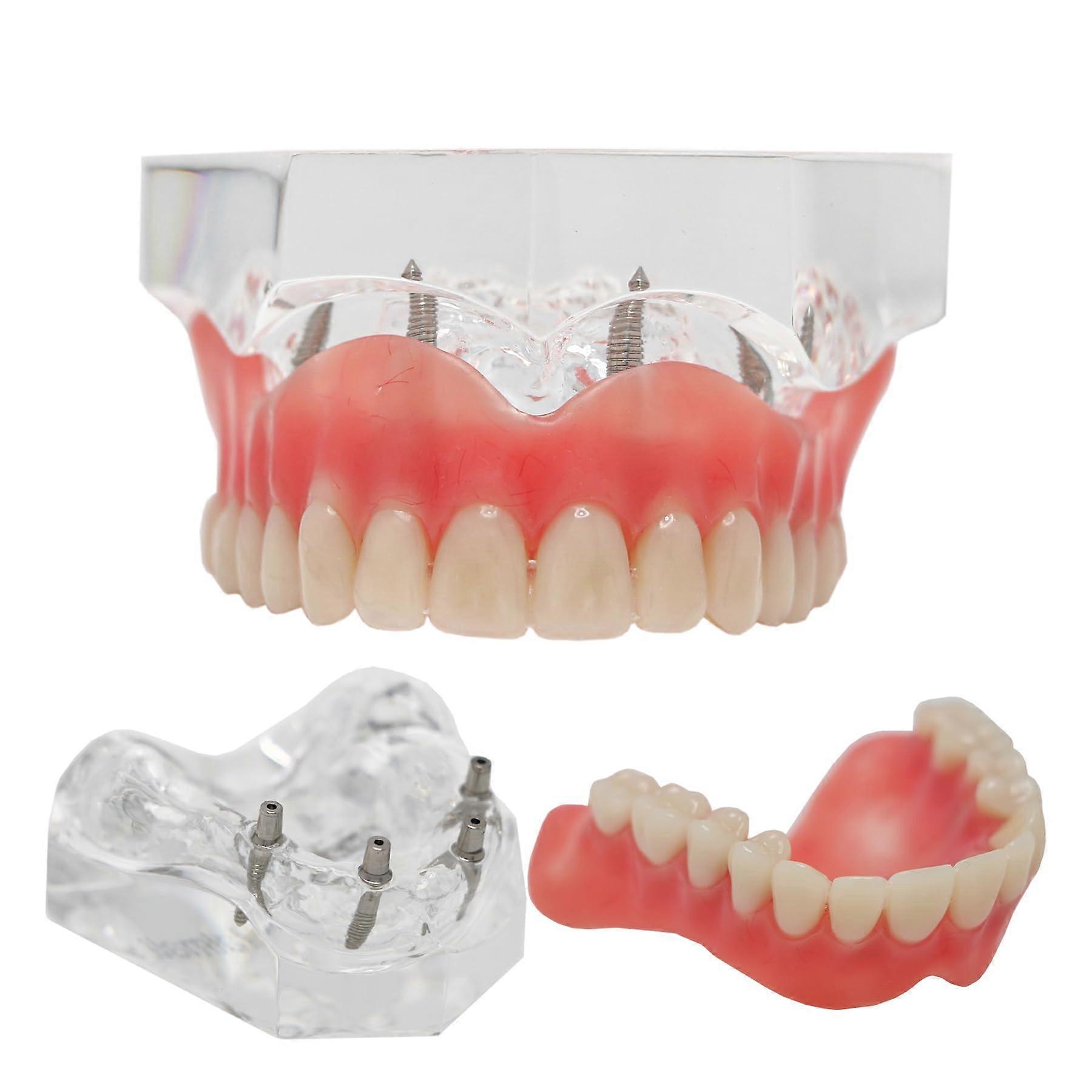 No product title provided Ref: 3893