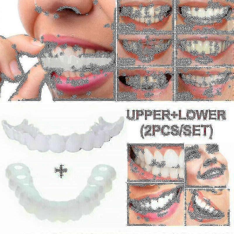 Snap On False Teeth Upper + Lower Dental Veneers Dentures Tooth Cover Set A