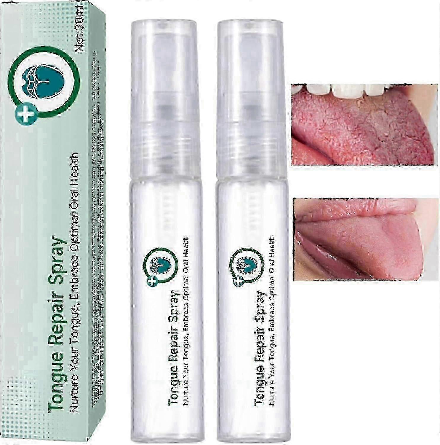 Tongue Repair Spray, Mouth Odor Eliminator for Dryness& Bad Breath,Fissured Tongue Relief Spray, Instant Dry Mouth Relief,Breath Freshener Spray