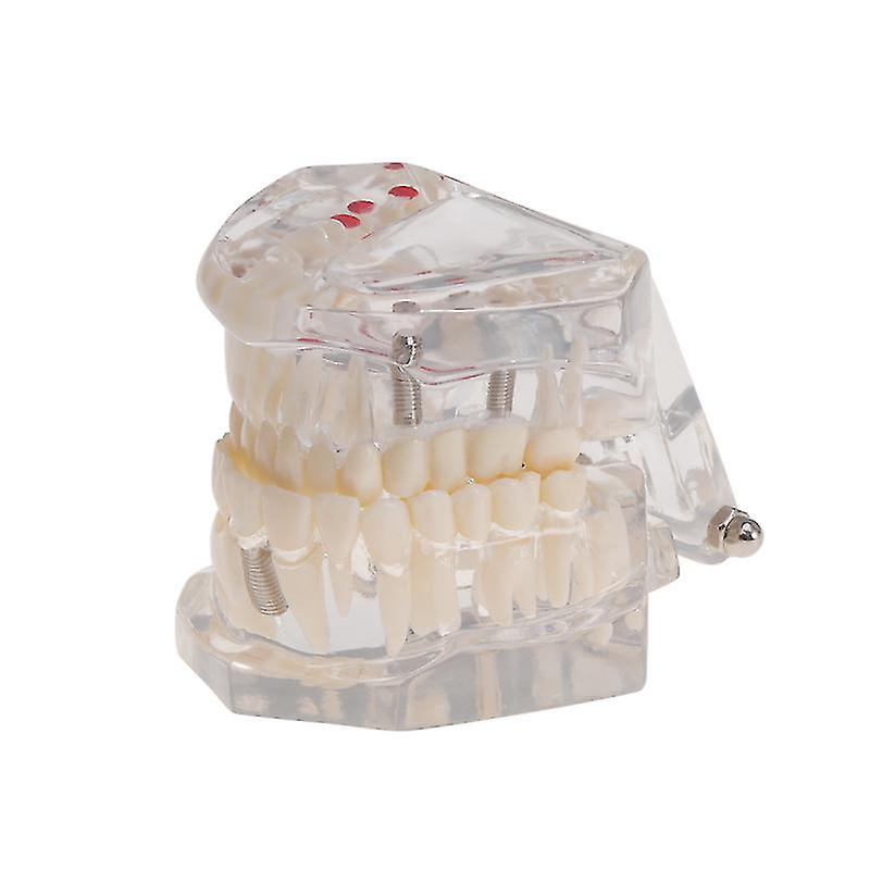 1pcs Dental Demonstration Model