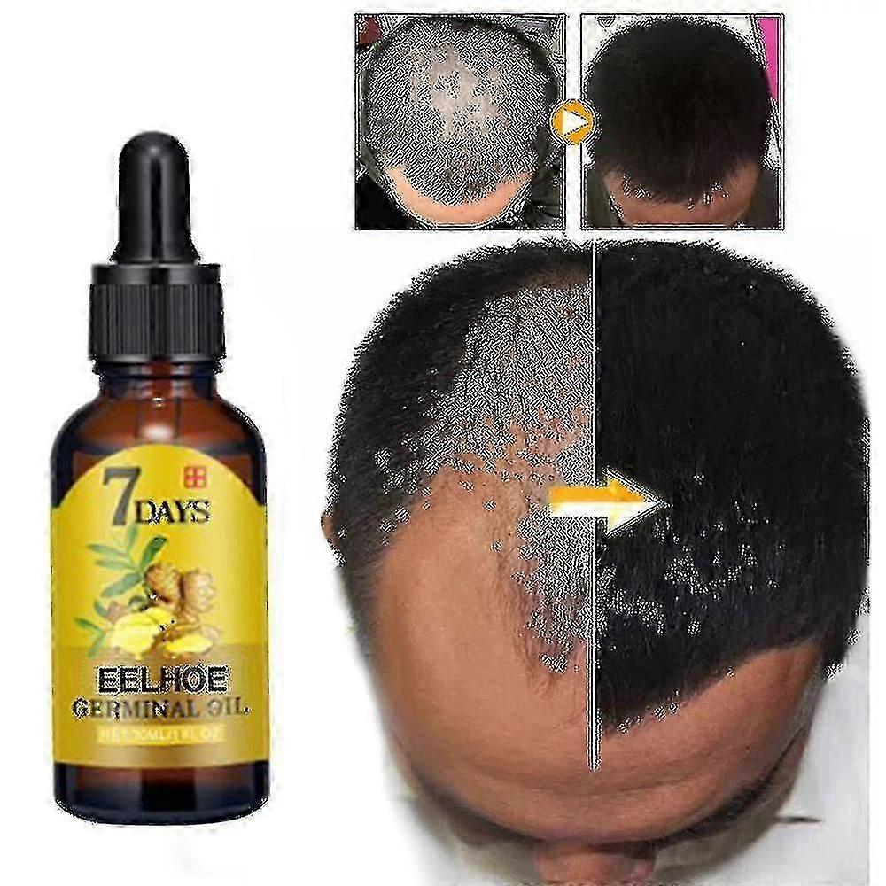 Το New2023 Ginger Hair Tonic θρέφει τις ρίζες των μαλλιών, βελτιώνει τη φωτεινότητα των μαλλιών, δυναμώνει τα μαλλιά, αποτρέπει τις επιπτώσεις