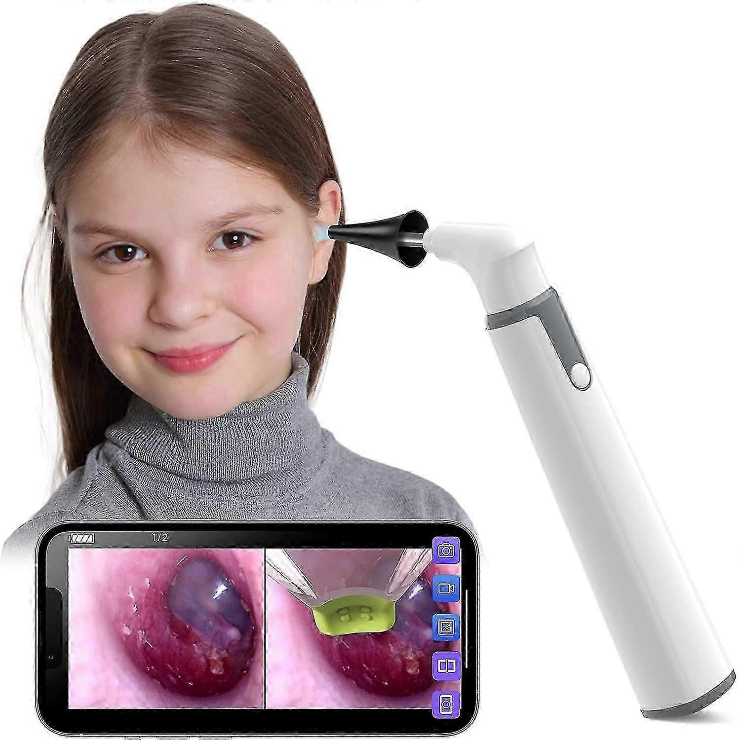 Wireless otoscope ear camera with dual view, 3.9mm 720phd wifi ear scope with 6 led lights