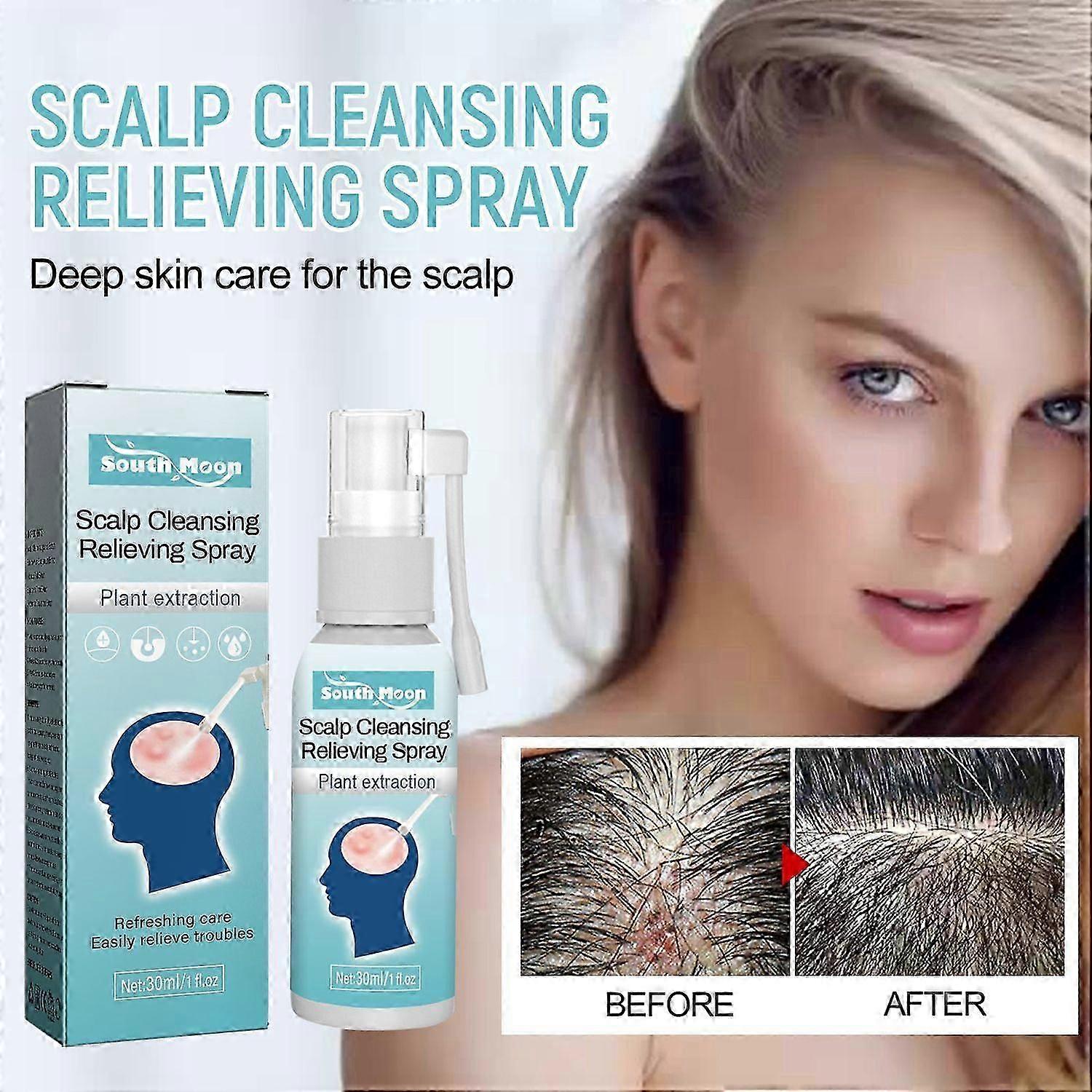 South Moon Scalp Cleansing Relieving Spray, Scalp Moisturizing Cleaning Dense Hair And Repairing
