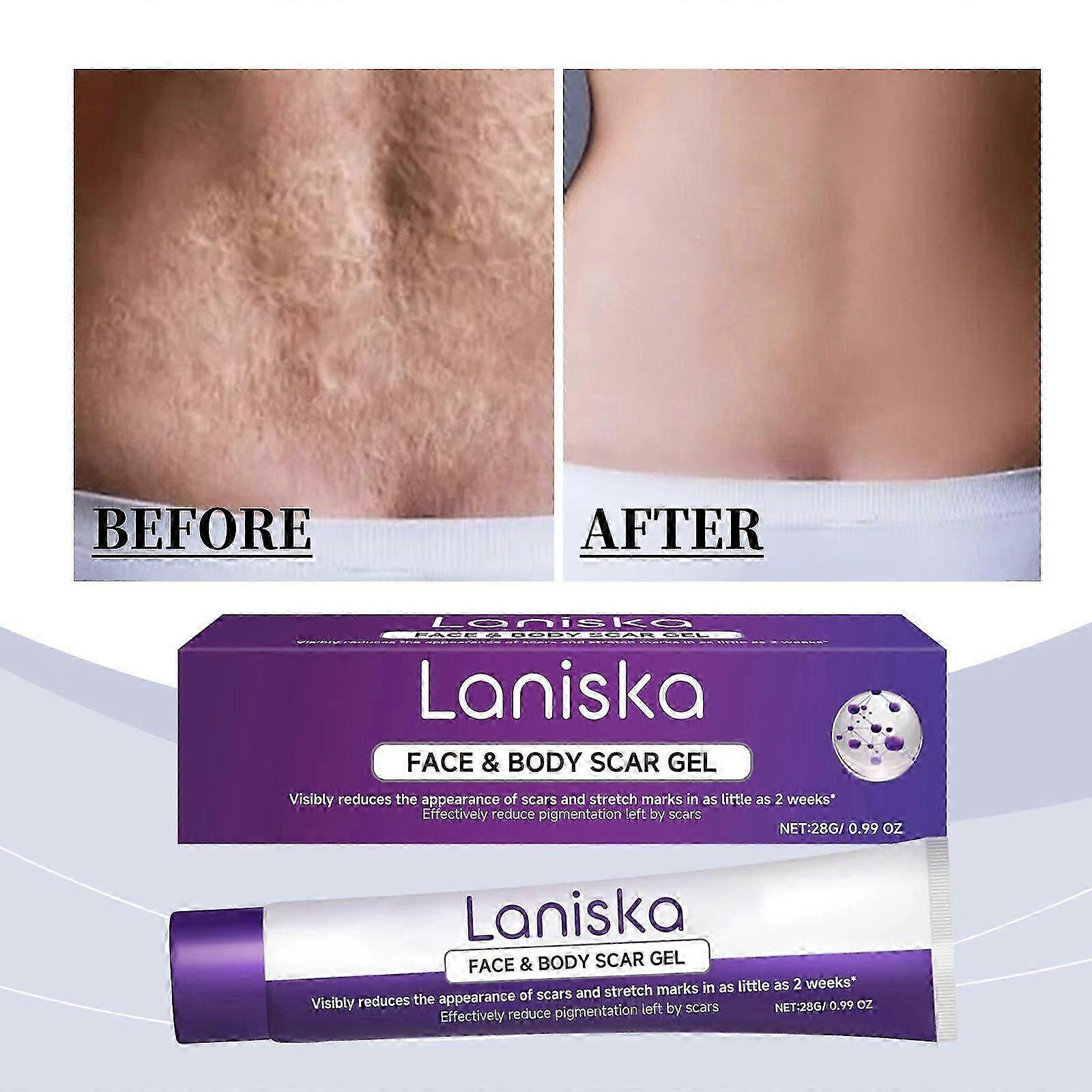 Avansert arrgel for ansikt og kropp, Scar Gel Cream reduserte synlige arr fra kirurgi, brannskader, akne, skader