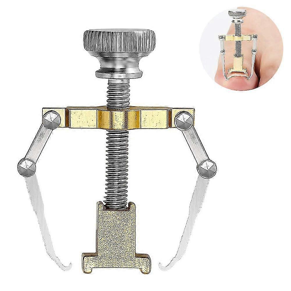 巻き爪矯正器リフターツールペディキュアつま先爪フットネイルケア、痛み&Rを排除