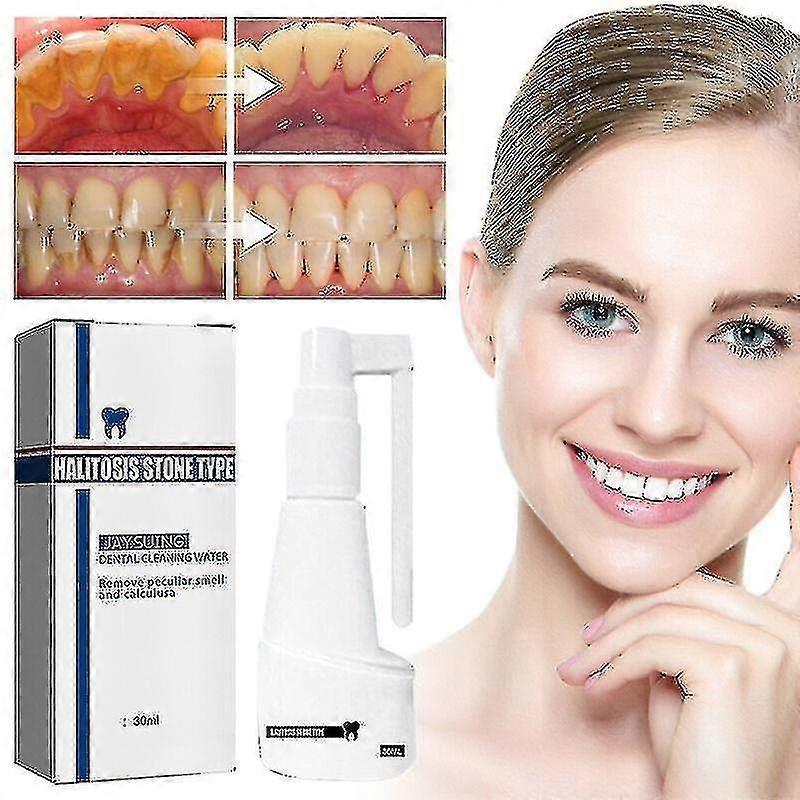 30mL 微積分溶解歯科スプレー口腔歯クリーナー歯石除去剤 HK