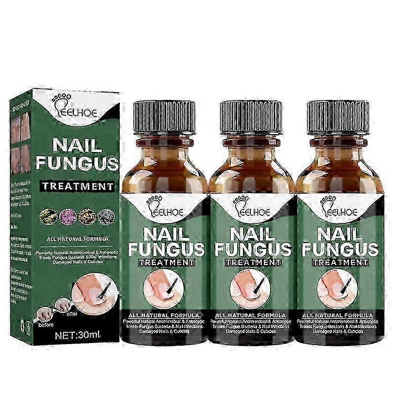 Erityisen luja kynsien korjaus Neste varpaankynnet ja kynsiliuoksen varpaankynnet ja kynnet korjaavat vaurioituneet ja värjäytyneet kynnet