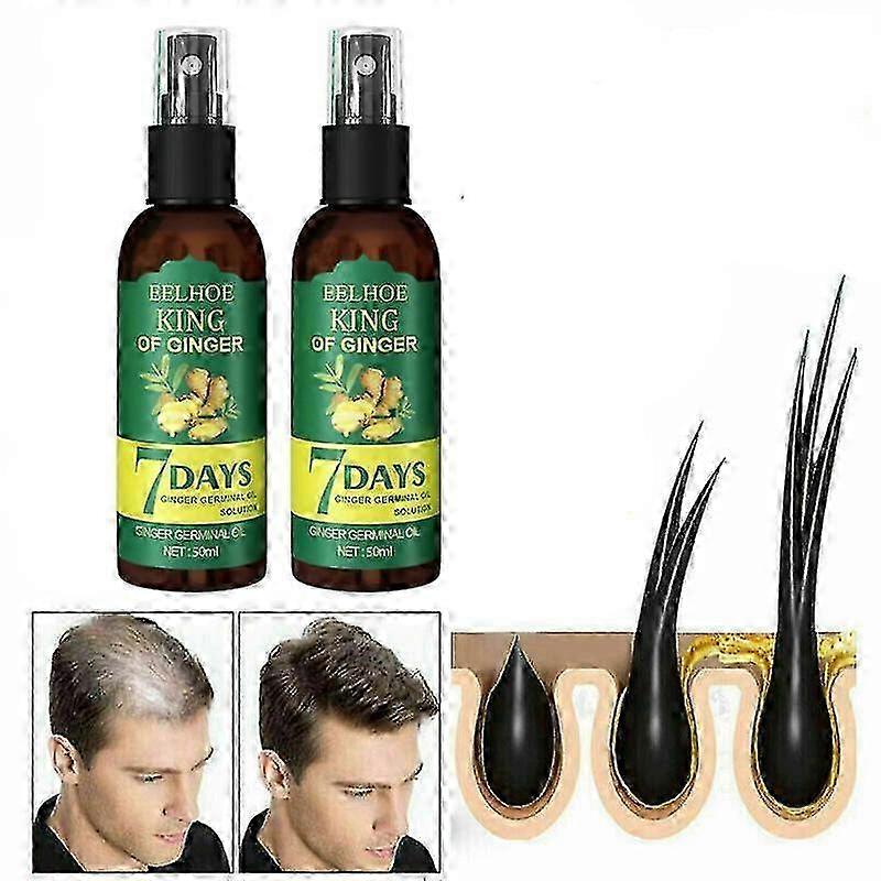 2025 2pcs Ginger Hair Regrowth Serum Spray