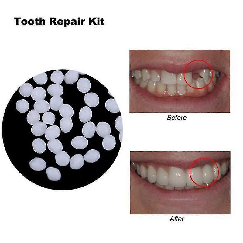 Barsinfi pol 10g/100g tooth and space denture solid glue resin denture adhesive dental dentist denture solid glue temporary tooth restoration kit