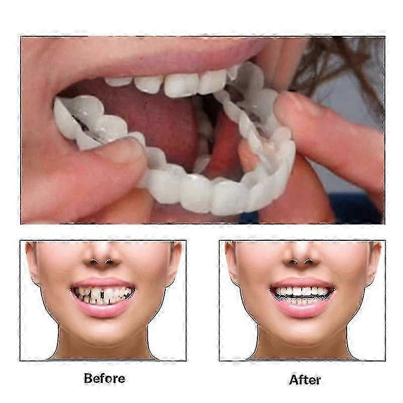 Snap On Smile Silicone Artificial Teeth Dentures
