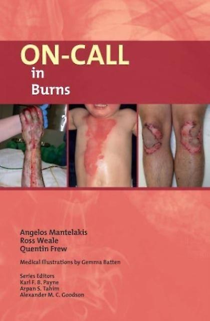 Oncall In Burns by Quentin Frew Paperback