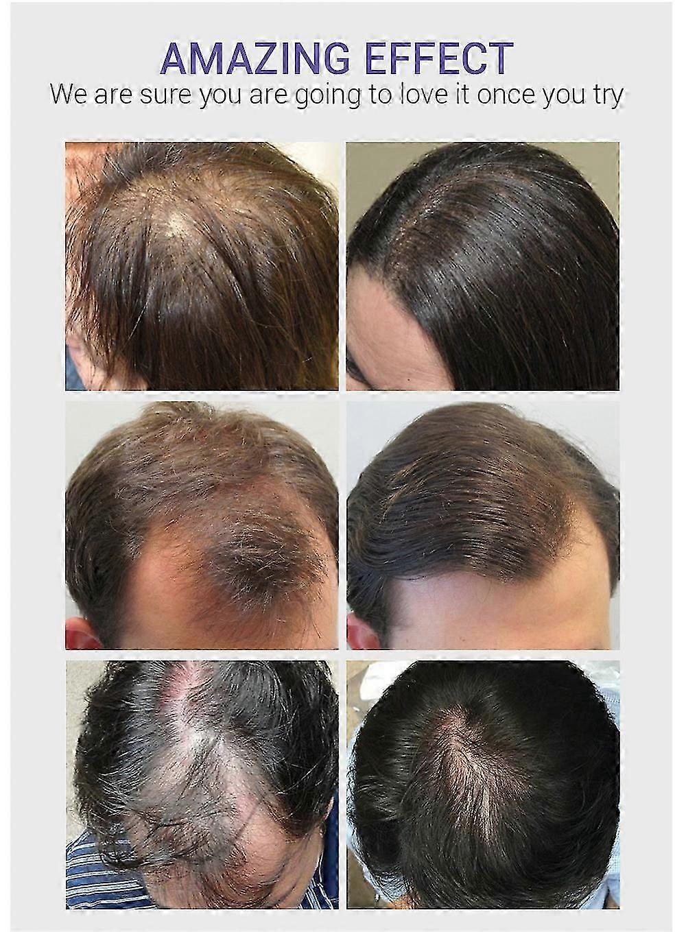 Pill Box Organiser 2 Times A Day, Portable 7 Day Pill Boxes, Tablet Organiser with Large Compartments (Clear Rainbow)