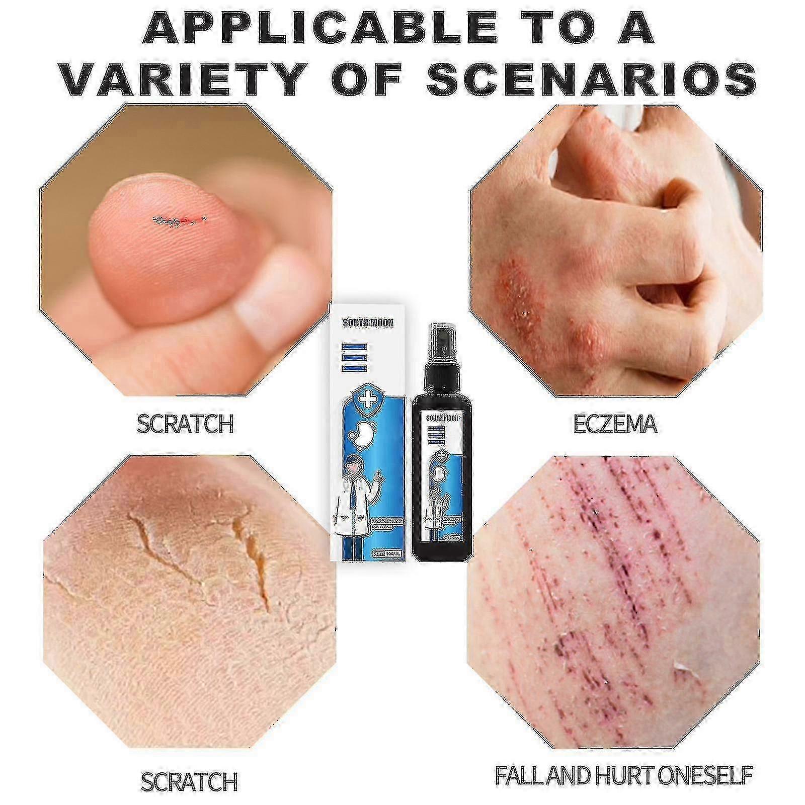 Arreparationsbehandling sårspray 100m