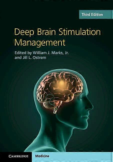 Deep brain stimulation management